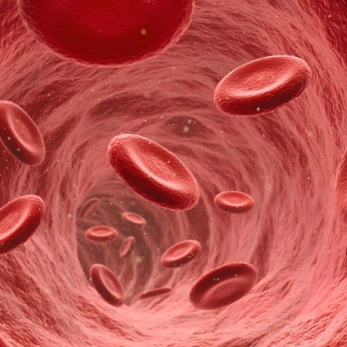 What is Sickle Cell Disease?